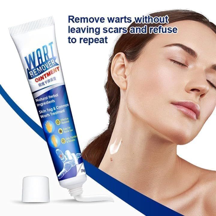 كريم إزالة الثآليل Wart Remover Cream
