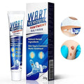 كريم إزالة الثآليل Wart Remover Cream