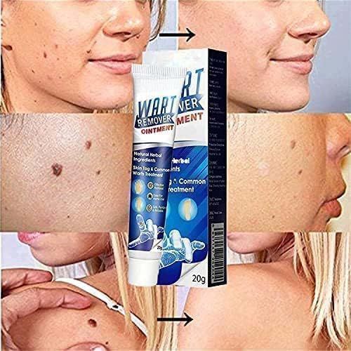 كريم إزالة الثآليل Wart Remover Cream