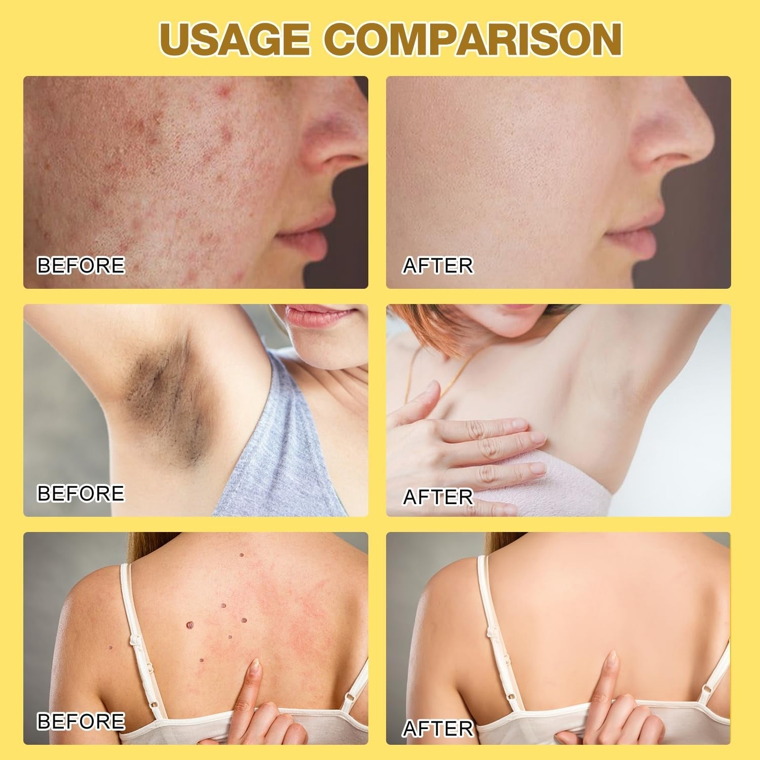 Bee Venom Skin Treatment Cream with Natural Extracts